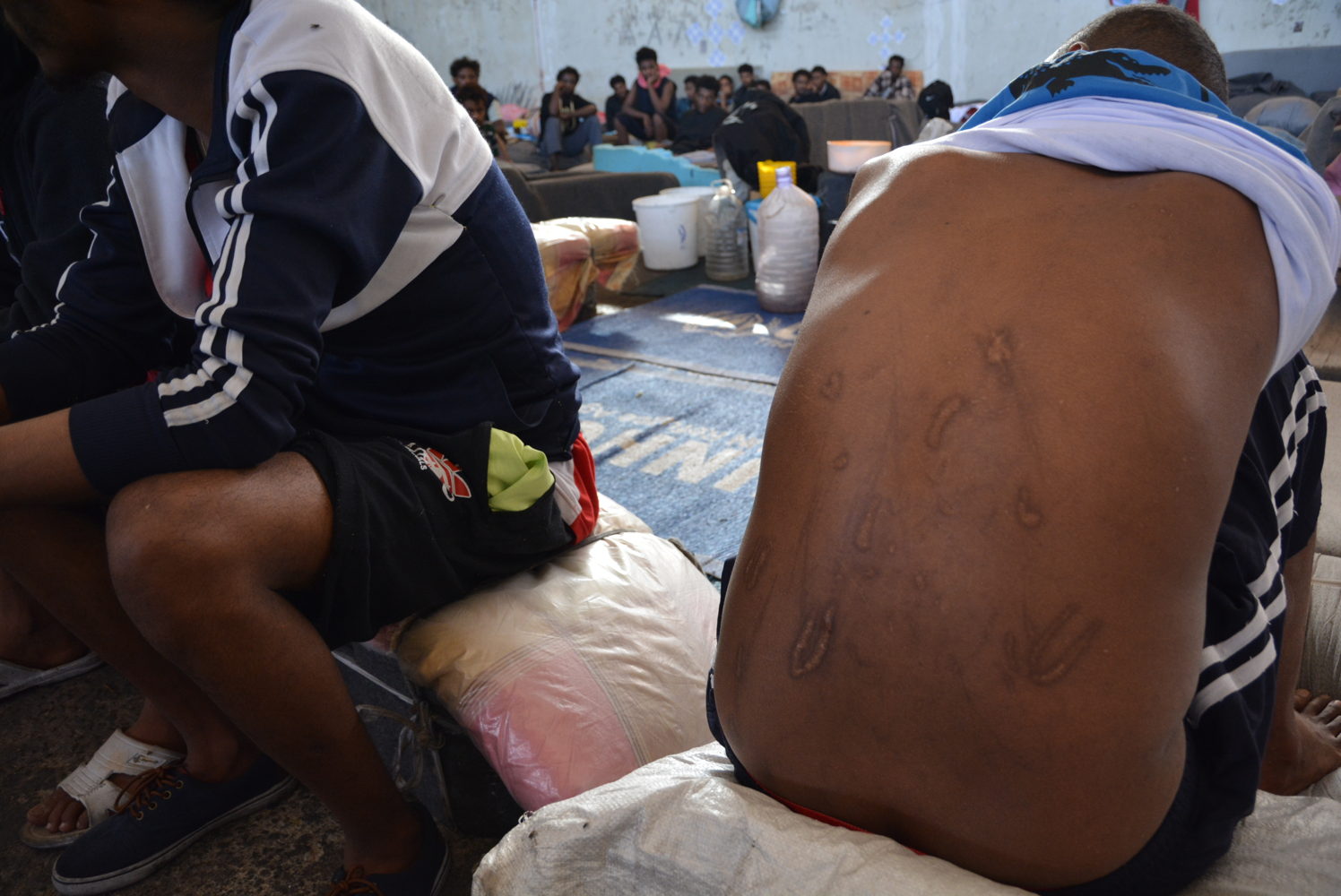 7) Most have already been through dreadful experiences in Libya, including being kidnapped by people traffickers who subjected them to rape and torture. Many suffer both physical and psychological consequences. © Jérôme Tubiana/MSF