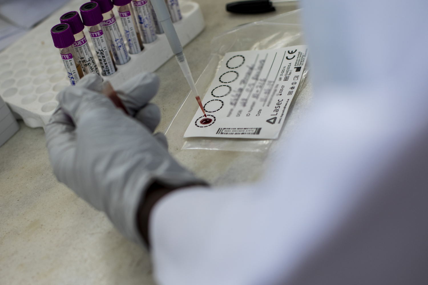 José Manuel, MSF lab technician, conducts tests to check patient's viral load during the first days after the 09 April resumption of the HIV-related activities in the MSF-supported Munhava health centre in Beira after Cyclone Idai hit the city. Photographer: Pablo Garrigos 