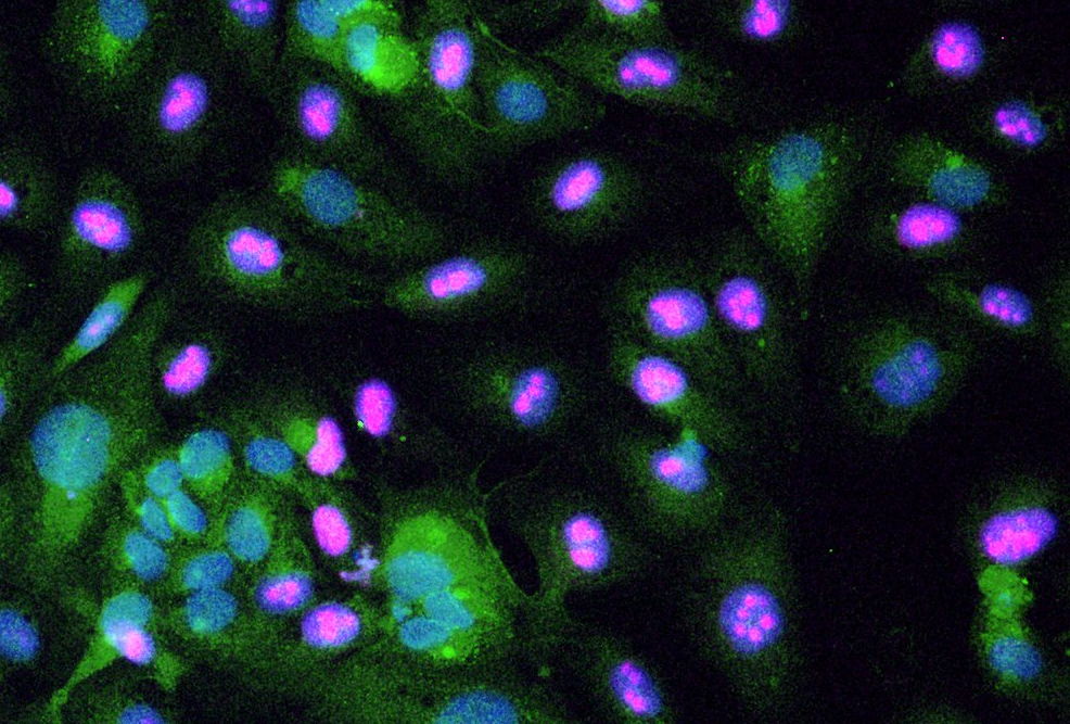 Expression of TRAIL (green) in proliferating (Ki-67+, magenta) and quiescent (Ki-67-) endothelial cells. Cell nuclei are shown in blue.