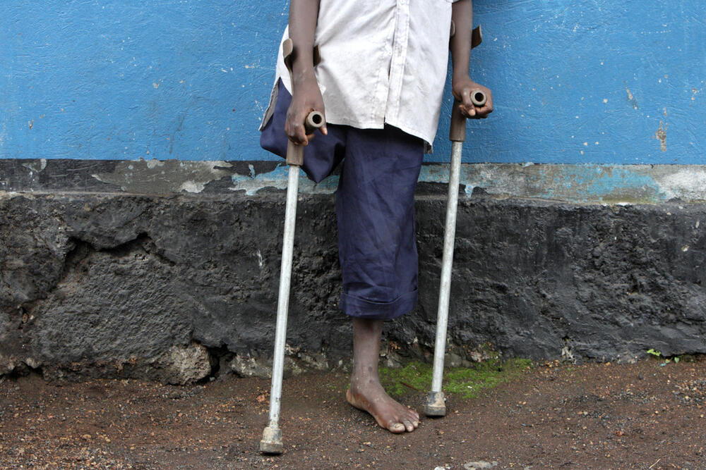 Garçon de 10 ans ayant perdu une jambe dans les combats en République démocratique du Congo / Photo, 05.12.2008 © Stefan Trappe / akg-images