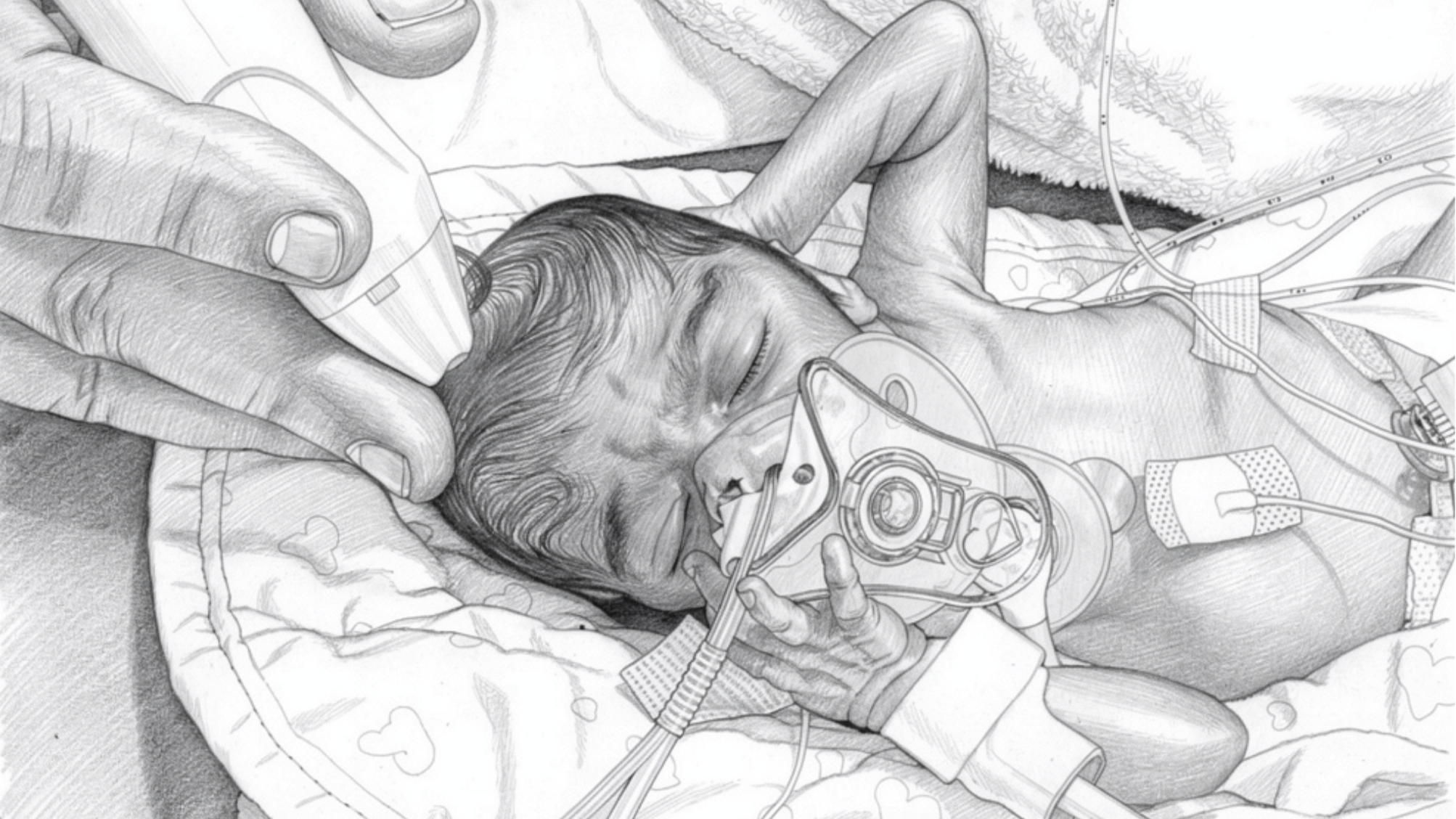 Risico op hersenschade bij premature baby’s onthuld door VUB-onderzoek naar aders in het brein 
