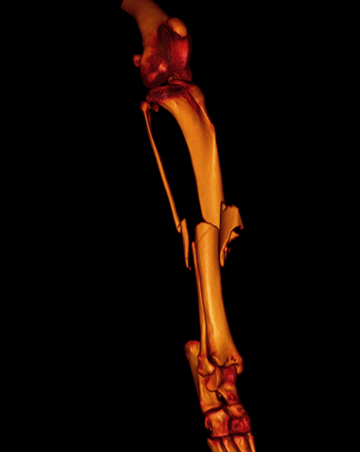3D scan met CT-scanner