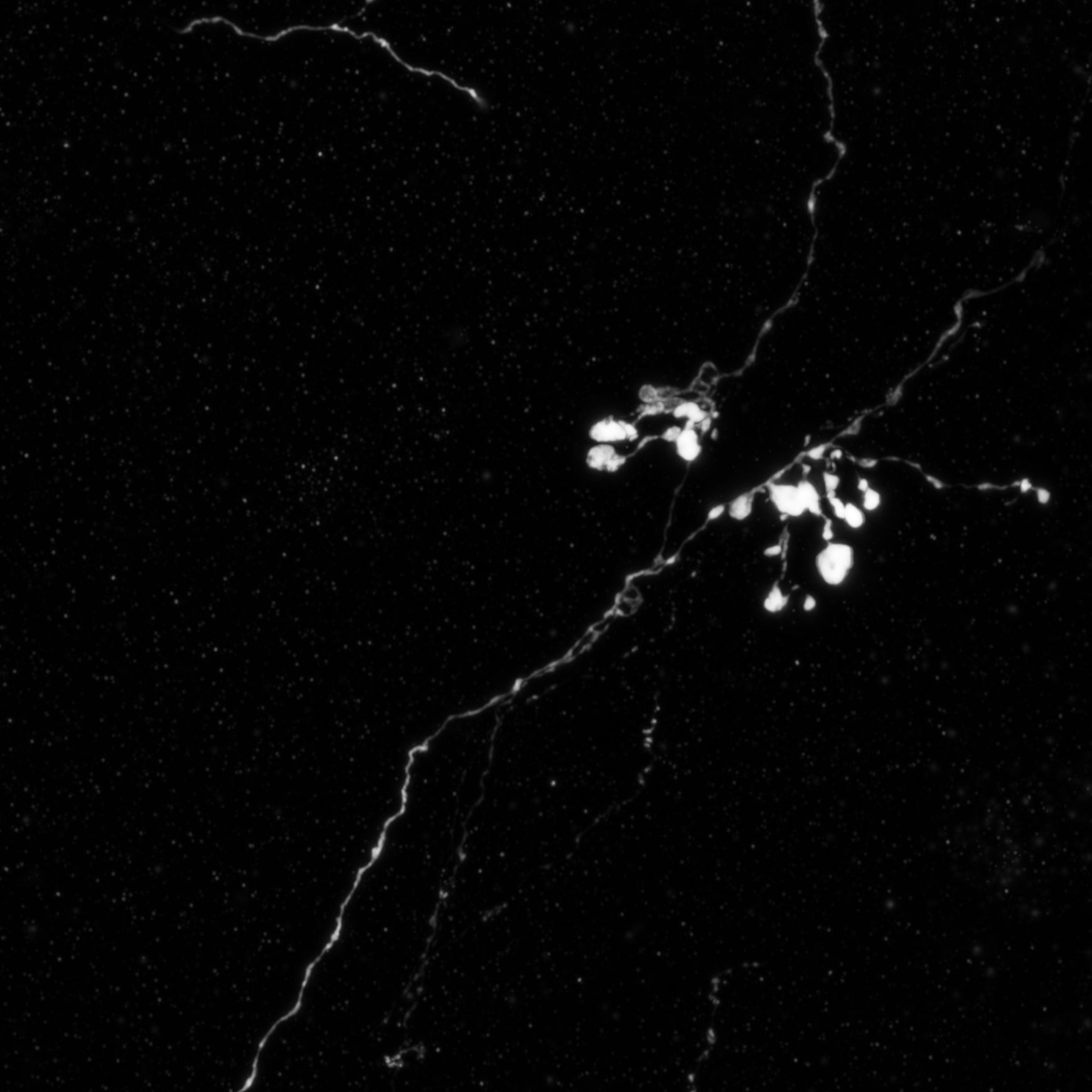 An MCH axon residing in the brain of a mouse model of Alzheimer's disease