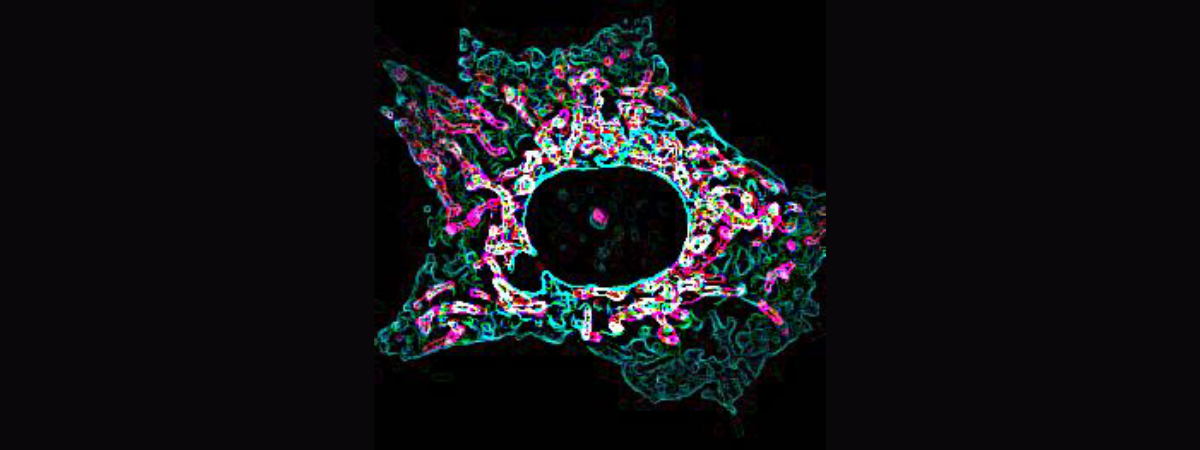 ER-Mitochondria contact sites fuel ferroptosis.
