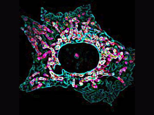 Killing cancer cells by boosting organelle bridges