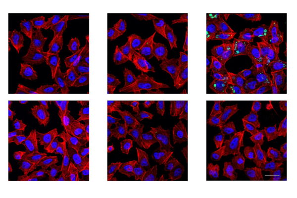 Human Aβ42 selectively accumulates in the cells and inhibits γ-secretase-mediated proteolysis (from eLife paper)