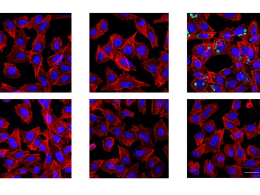 Researchers unravel complexities of Alzheimer’s disease in protein fragments and plaque diversity