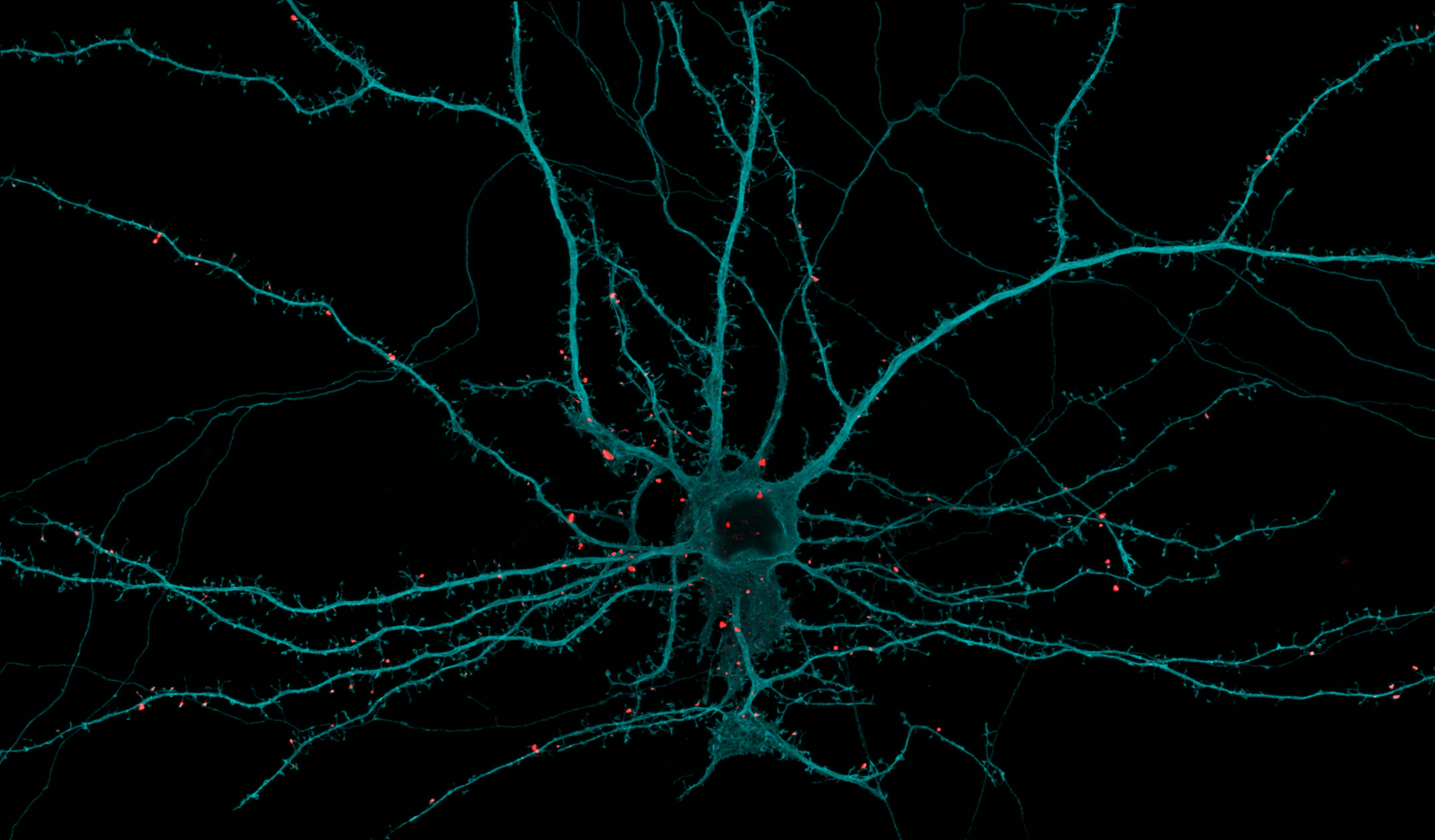 Cultured mouse cortical neuron demonstrating enriched PLCXD2 expression in a subset of dendritic spines Cultured mouse cortical neuron demonstrating enriched PLCXD2 expression in a subset of dendritic spines