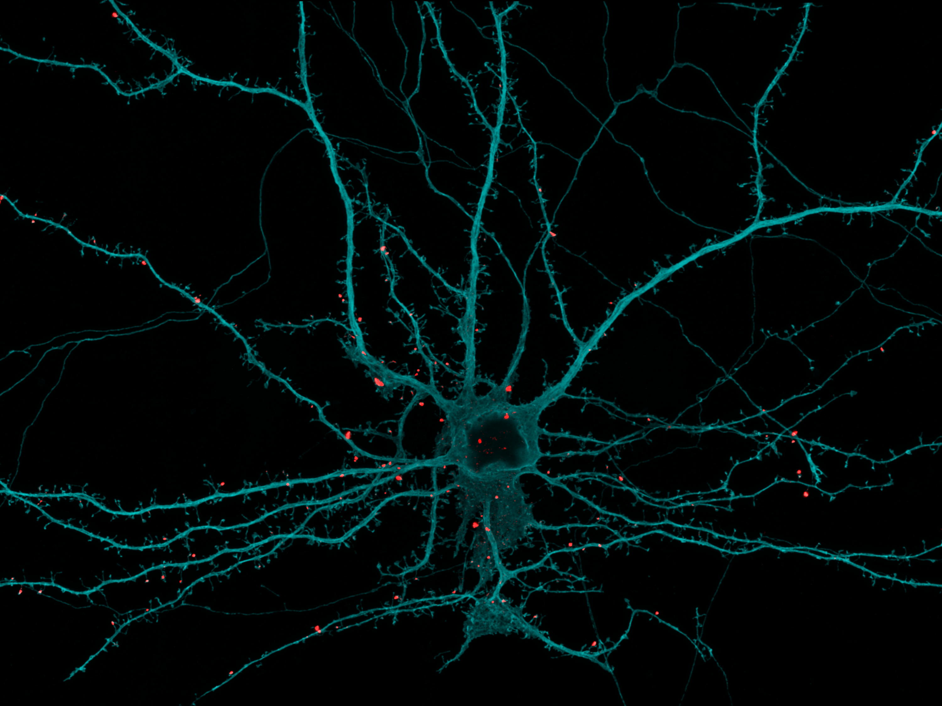 Researchers identify molecular brake that regulates synaptic maturation