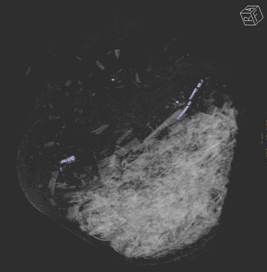 gevonden urne CT-scan