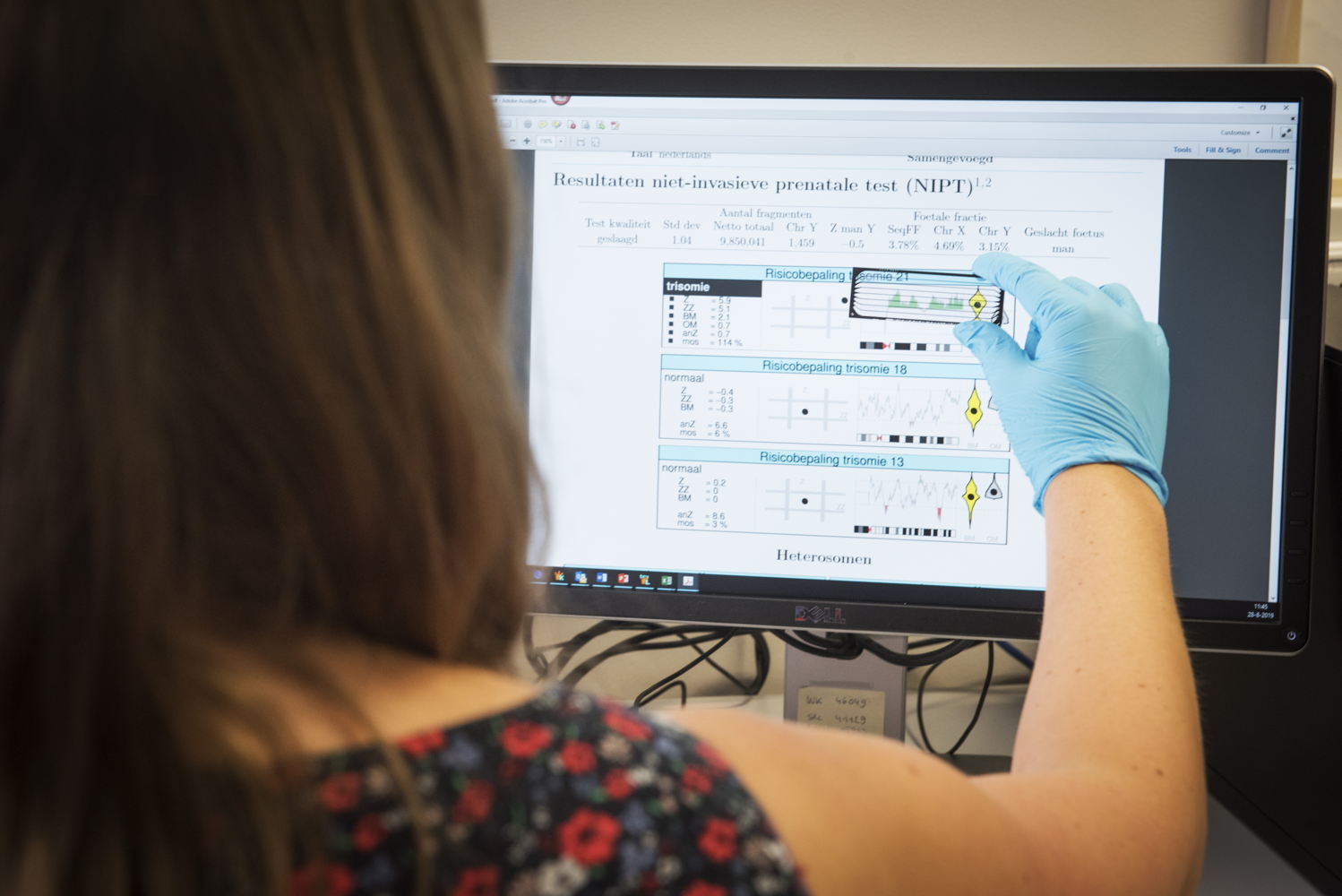 Meer dan 80 procent van de zwangere vrouwen laat vandaag de NIPT-test uitvoeren. Oorspronkelijk was de test bedoeld om grote chromosomale afwijkingen bij baby's op te sporen, maar er worden alsmaar meer mogelijke bijkomende bevindingen ontdekt.