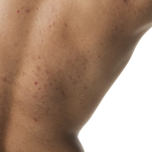2024-03-12-ORD-BodyCare-Human-BodyScape-NoProduct-E-02-1x1 2024-03-12-ORD-BodyCare-Human-BodyScape-NoProduct-E-02-1x1