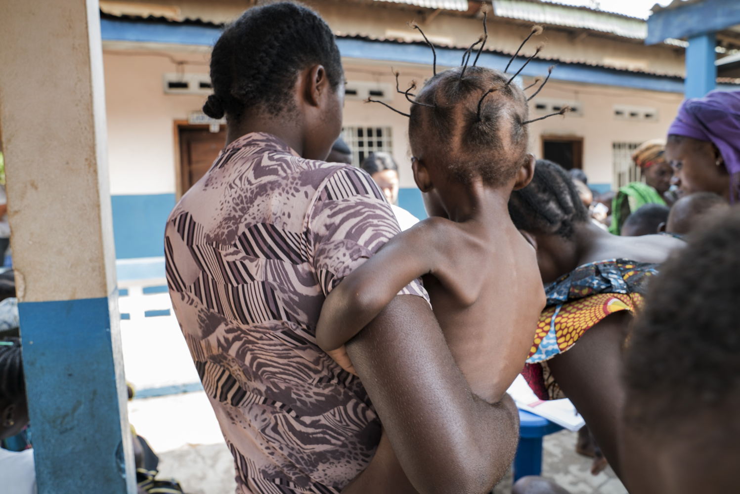 Mother and daughter admitted for treatment of malnutrition at the Mukendi health centre in Kasai, DRC