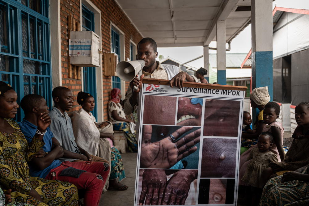 An MSF health promoter explains the signs and symptoms of mpox to camp people present inside the health centre supported by MSF in the Kanyaruchinya displacement site, on the outskirts of Goma. Date taken: 28/08/2024 | Photographer: Michel Lunanga | Location: North Kivu 
