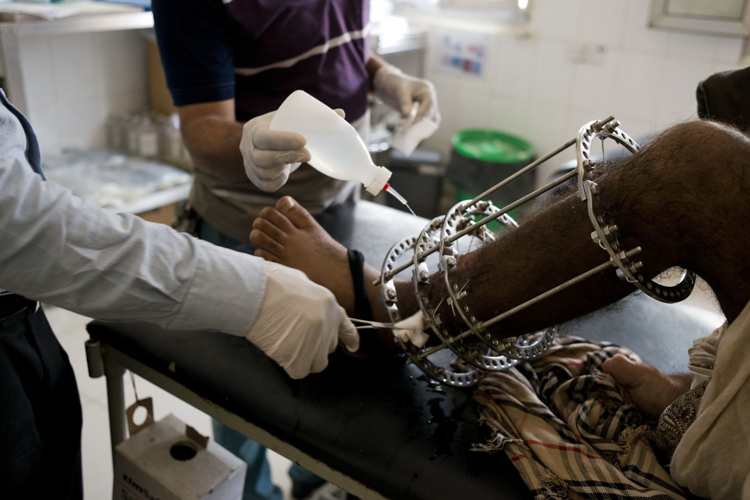 MSF Nurses and medical providing medical assistants in Qataba hospital to wash out a man’s leg wound, infected due to long periods of sitting at home with external fixation for a broken leg, July 22, 2015 in Qataba, Al-Dhale governorate, Yemen. Credit MSF