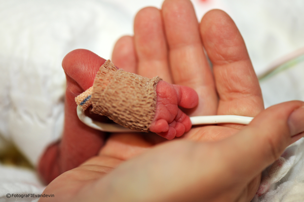 Oudervereniging VVOC vraagt Minister Onkelinx om steun voor prematuren naar aanleiding van de Werelddag van het Vroeggeboren Kind
