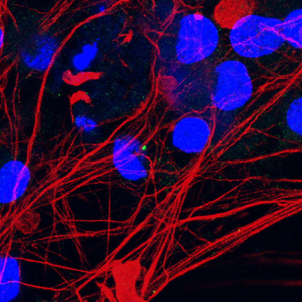 Motor neurons with damaged primary cilia (green) from patients with the C21orf2 mutation.