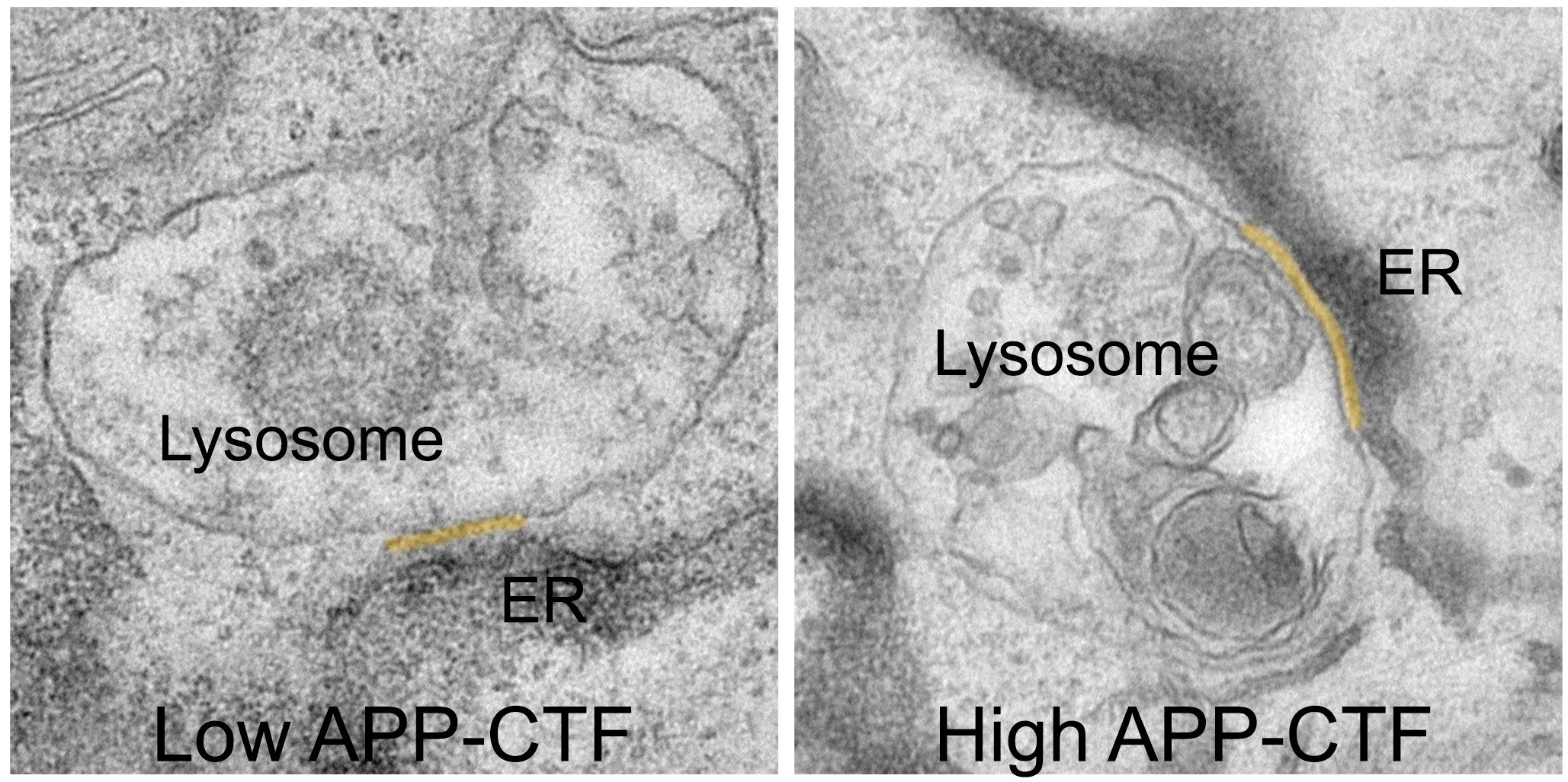 APP-C-Terminal Fragments (APP-CTFs) accumulate between the endoplasmic reticulum and the lysosomes