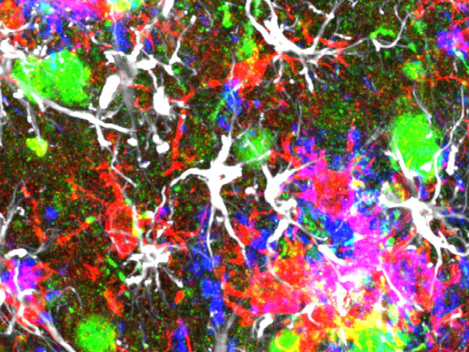 Nieuw onderzoek ontdekt hoe neuronen sterven bij Alzheimer