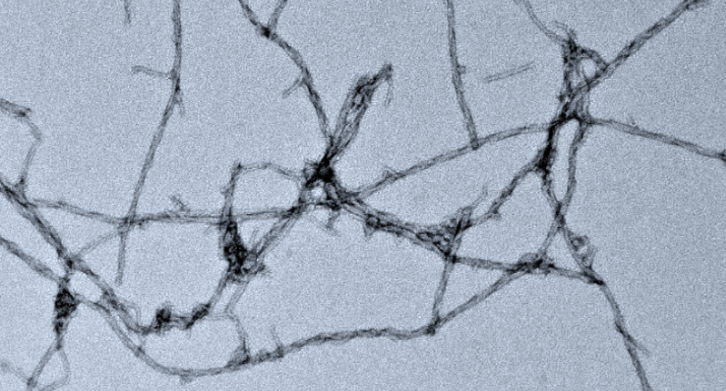 An electron micrograph of protein fibrils