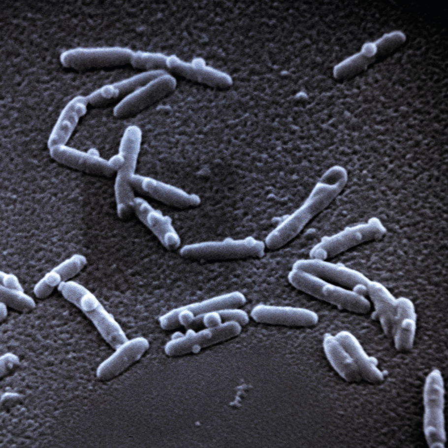 legionella bacterie