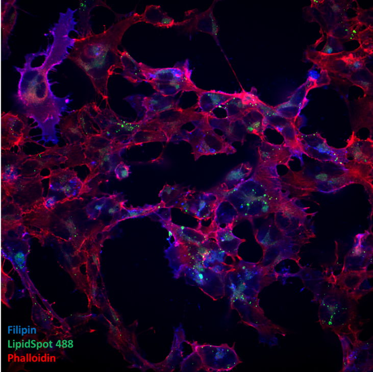 iPSC-derived Schwann cell precursors, blue filipin (free cholesterol), green LipidSpot 488 (lipid droplets), red phalloidin (cell mask). Credit: Alessio Silva