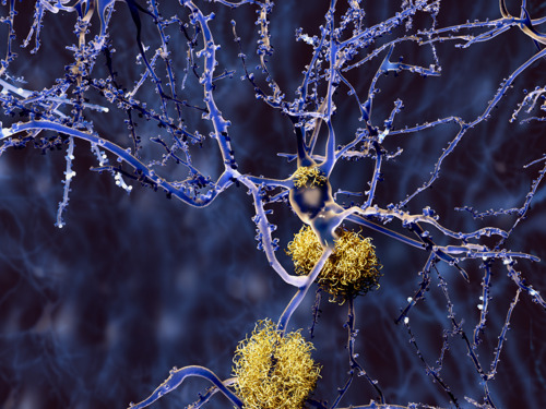 Nieuwe hersenscanner moet ziekte van Alzheimer in een veel vroeger stadium kunnen opsporen