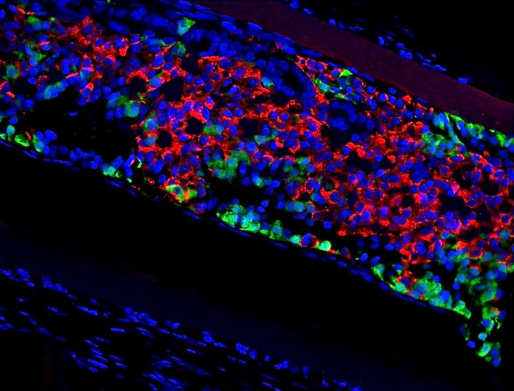 Preklinische studie toont vorming van insuline-producerende beta-cellen (in het rood) en andere endocriene cellen in een subcutaan getransplanteerd device met humane stam cel gederiveerde pancreas progenitor cellen