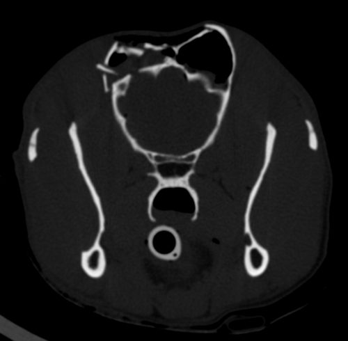 CT-scan