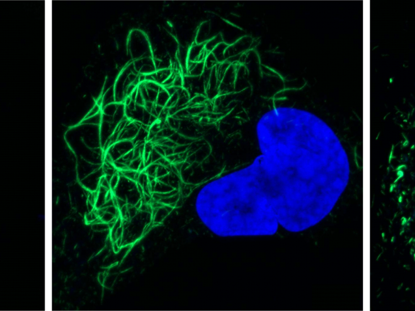 Scientists create protein ‘seeds’ that trigger key pathological features of ALS and frontotemporal dementia