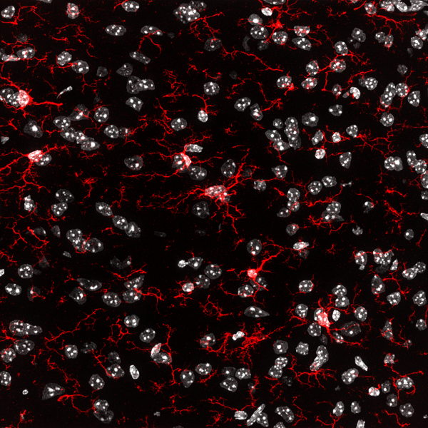 Breakthrough in cell therapy for brain diseases
